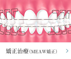 MEAWを用いた矯正治療